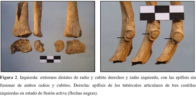 Detalle del estudio antropológico
